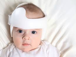 Flacher Baby Schadel Wie Helmtherapie Hilft Wireltern Ch