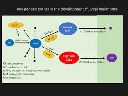 Ultraviolet (uv) rays from the sun or tanning … Overview Of Bap1 Cancer Predisposition Syndrome And The Relationship To Uveal Melanoma Sciencedirect