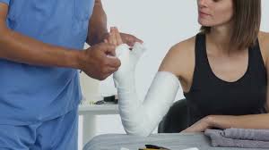 Image result for Long Arm Cast