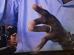 Check spelling or type a new query. Ebro In The Morning A Twitter Espn Nfl Analyst Booger Mcfarland S Hands After Playing 8 Years In The Nfl Ebrointhemorning