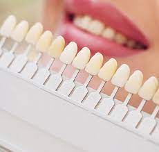 Low Cost 3m Lava Premium Dental Crowns South Delhi India