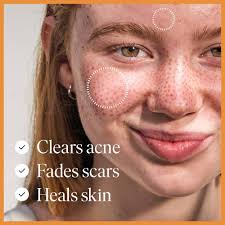 Amazon.com: 47 Skin Hydrating Face Serum for Clearing Acne and Scars,  Anti-Blemish & Scar Repair Serum Skincare Treatment with Silver Chitoderm  Smooth ...