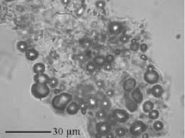 Image result for Eragrostis mildbraedii