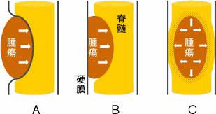 内科 脳神経内科 腎臓・高血圧内科 リウマチ・膠原病内科 循環器内科 糖尿病・代謝・内分泌内科 腫瘍・血液内科 呼吸器内科 接種 小児神経外来 皮膚科（小児診療） 小児一般外来 小児血液腫瘍外来 耳鼻咽喉科（小児診療） 産科 未熟児フォローアップ 眼科（小児診療） 小児循環器外来 小. Neuroinfo Japan è„Šé«„è…«ç˜