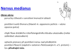 A tak se i skutečně stalo. Traumatologie Horni Koncetiny Ppt Stahnout