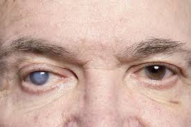 Image result for Isoglossa cataractarum