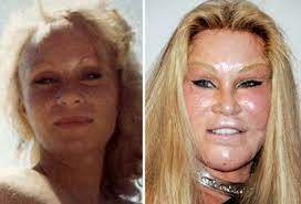 As the saying goes, eyes are the window to the soul, so it is important to keep them as sharp and clear as possible. Kelicuk Tumblr Com Plastic Surgery Gone Wrong Dangers Of Poor