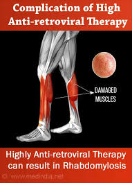 These include mobility, stability, posture, circulation, digestion, and more. Antiretroviral Therapy For Hiv Treatment