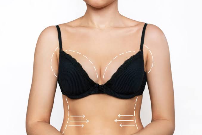 Breast Lift Dubai – Sculpted & Natural Results 2026