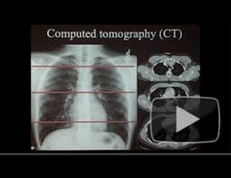 Brett Elicker Md Ucsf Radiology