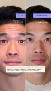 Beautiful Glow Spa & BG Medical Aesthetics 樂沙醫美容中心 (@bgmedicalaesthetics) •  Instagram photos and videos