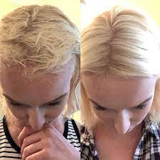 Bleaching takes its toll on your hair, making it more prone to breakage and split ends and typically giving it an overall rougher, less lustrous appearance. Brittle Hair After Bleaching Treatment For Bleached Hair Bleached Hair Deep Conditioning Hair Treatment