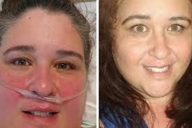 Fundraiser for RACHEL MILSTEAD by Denise Wilkins : Help Rachel "Breathe"  Easier