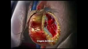 We did not find results for: Voce Sabe O Que E Sepse Doenca Pode Levar A Morte Youtube