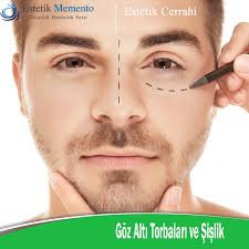 Goz Alti Torbalari Sislikleri Yuz Estetiginin Guzelligini Etkilemesin By Estetik Memento Medium