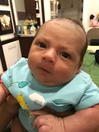 Hair loss in babies is very common. Baby Looks Like A Balding Old Man December 2016 Babies Forums What To Expect