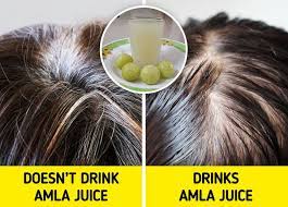 Use the juice of amla mixed with almond oil to curry leaves contain valuable nutrients, which help in preventing the malfunctioning of the hair follicles, thereby reducing the occurrence of grey hair 10 Remedies That Might Treat And Prevent Gray Hair