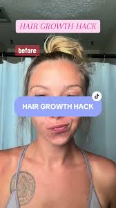 This onion rosemary shampoo will transform your hair #onionshampoo  #rosemaryshampoo #hairgrowth #postpartumhairloss #hairgrowthtips  #hairgrowthjourney