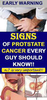 In black people, prostate cancer is also more likely to be aggressive or advanced. What Are The Early Signs Of Prostate Cancer In A Man 12 Early Warning Signs Of Prostate Cancer That Every Guy Sadly Many Men Don Not Find Out They