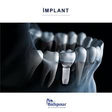 Özel ballıpınar ağız ve diş sağlığı polikliniği firması afyonkarahisar ili afyon merkez ilçesinde diş hekimi sektörlerinde faaliyet göstermekte olup 2020 yılı içerisinde 91 kişi tarafından ziyaret edilmiş ve 0 kişi. Ballipinar Agiz Ve Dis Sagligi Poliklinigi Ballipinartr ××××××¨
