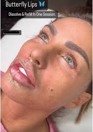 Upkeep Medical Spa — Injections, Aesthetics, Laser And Body Contouring In  New York City And Dallas