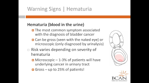 Blood in the urine (hematuria) sometimes is a sign of bladder cancer. Bladder Cancer Risks Warning Signs Part Ii Warning Signs Youtube