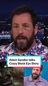 Adam Sandler's Funny Black Eye Story
