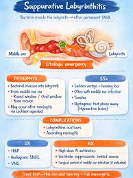 Image result for Bacterial Labyrinthitis