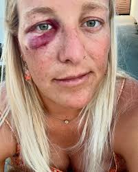 Haley Werner (@whaleywerner) · Instagram 照片和视频