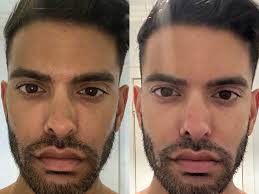 Aussie eczema and psoriasis sufferer launches skincare range for sensitive  skin and shoppers are 'blown away'