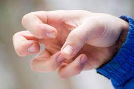 Epilepsie Symptome Ursachen Epileptischer Anfalle