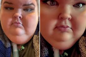 1000-Lb Sisters star Tammy Slaton shows off unfiltered face in new video as  she’s ‘improving’ in rehab for wei