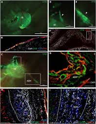 Of the tract within the peritoneal cavity, it is lined by the mesothelium. Surgical Adhesions In Mice Are Derived From Mesothelial Cells And Can Be Targeted By Antibodies Against Mesothelial Markers Science Translational Medicine