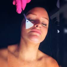 Discounted skincare services available now