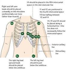 92 Best 12 Lead Ekg Images Cardiac Nursing Icu Nursing