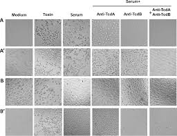 Geek squad offers unmatched support for products from appliances to tvs. Plos One Identification Of Toxemia In Patients With Clostridium Difficile Infection