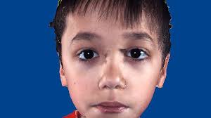 Autism tied too many brain cells: Will finding bring better diagnosis?