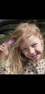 Gum stuck in hair removal tips needed