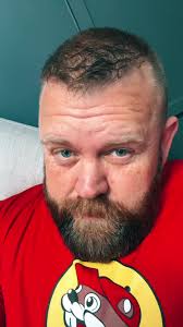 What Happened to Jolly Good Ginger Teeth