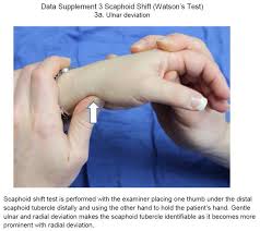 Image result for Scaphoid Shift Test