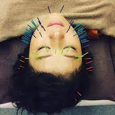 regrann from haribo519 repost hirononederland with repostapp ご来院有難うございました 刺さってる o 2 美容鍼 美容針 hari instagram posts instagram pictures instagram