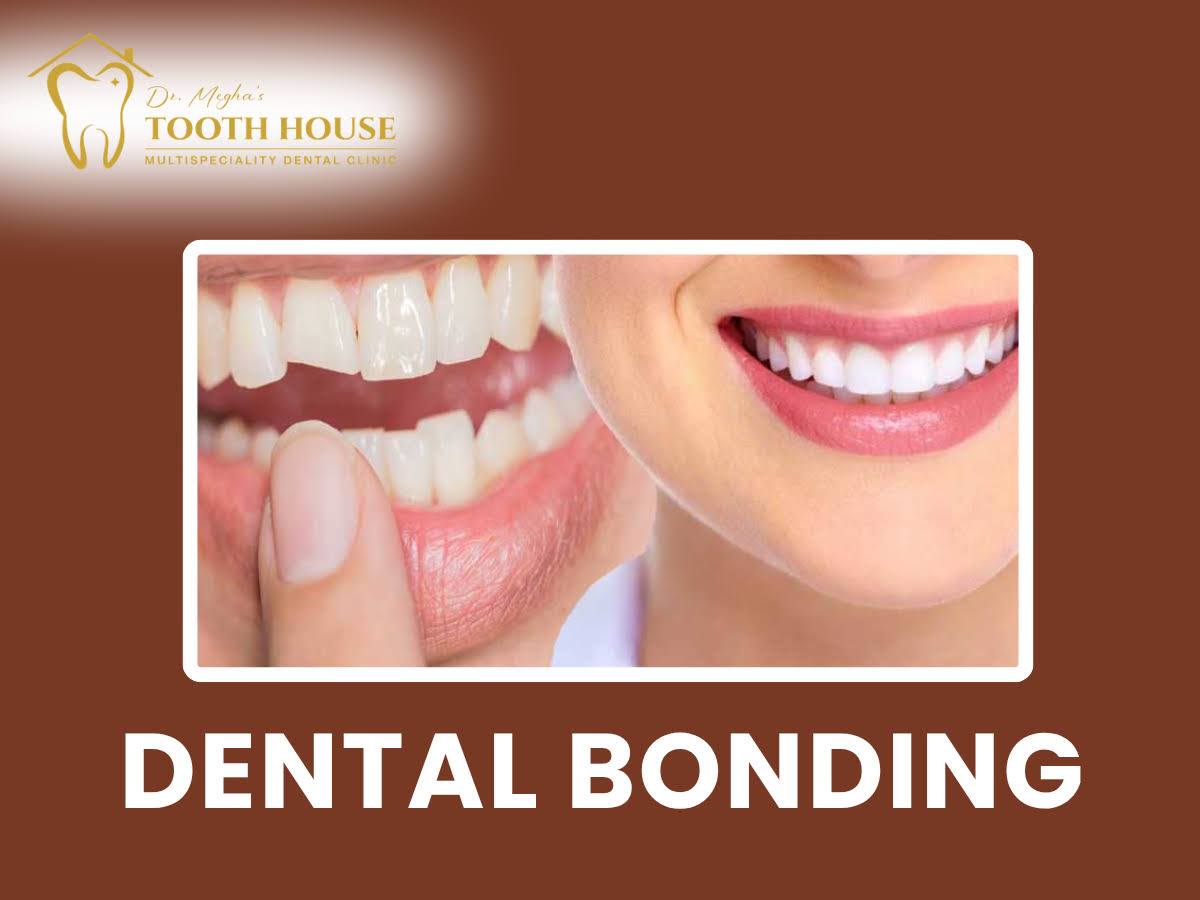 Dental Bonding product image