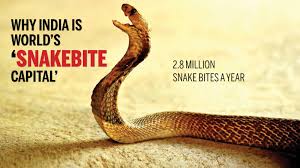 This may result in redness, swelling, and severe pain at the area, which may take up to an hour to appear. Snake Bites The Deadly Health Crisis That S Hidden From Our Gaze Times Of India