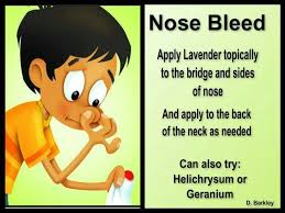 Nose Bleed Protocol Essential Oils For Kids Order Essential Oils Diy Essential Oil Recipes