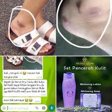 Sabun yang dihasilkan dari teknologi negara sakura ini mengandung vitamin e dan aha guna menjaga kelembaban kulit dan melindungi kulit badan dan wajah dari interaksi dengan sinar uv. Sabun Honey Glow