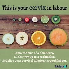 Pin On Pregnancy Childbirth