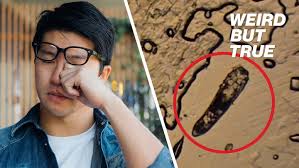 Gross eyelash mites live rent-free