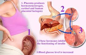 Image result for diabetes mellitus causes