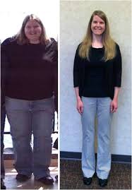 Pin On Weightloss Success Stories