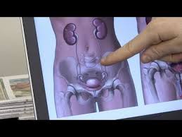 Treating Preventing Urinary Tract Infections Youtube